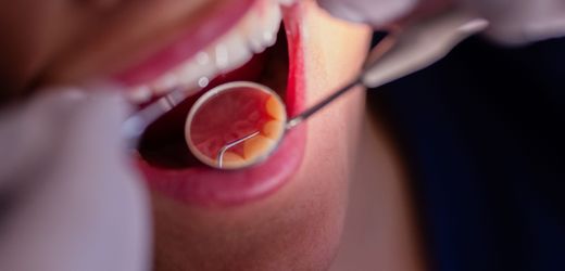 zahnarztekammer:-versorgungswerk-fordert-50-millionen-euro-von-ex-direktor